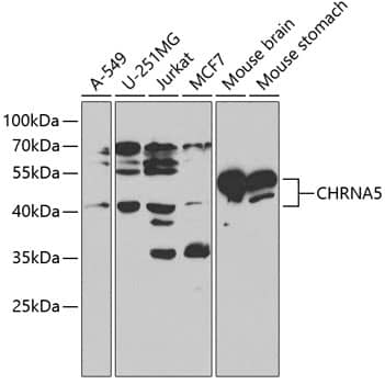 Western Blot: Nicotinic Acetylcholine R alpha 5/CHRNA5 Antibody [NBP3-35746] - Western blot analysis of various lysates using Nicotinic Acetylcholine R alpha 5/CHRNA5 Rabbit pAb at 1:1000 dilution.Secondary antibody: HRP-conjugated Goat anti-Rabbit IgG (H+L) at 1:10000 dilution.Lysates/proteins: 25ug per lane.Blocking buffer: 3% nonfat dry milk in TBST.