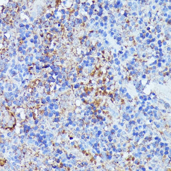 Immunohistochemistry Septin-1 Antibody