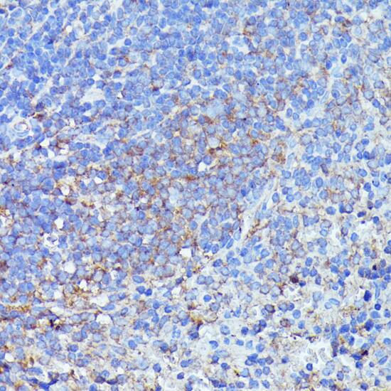 Immunohistochemistry Septin-1 Antibody - BSA Free