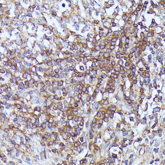 Immunohistochemistry Septin-1 Antibody - BSA Free