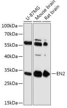 Western Blot: engrailed homeobox 2 Antibody [NBP3-35750] - Western blot analysis of various lysates using engrailed homeobox 2 Rabbit pAb at 1:1000 dilution.Secondary antibody: HRP-conjugated Goat anti-Rabbit IgG (H+L) at 1:10000 dilution.Lysates/proteins: 25ug per lane.Blocking buffer: 3% nonfat dry milk in TBST.Detection: ECL Basic Kit.Exposure time: 90s.