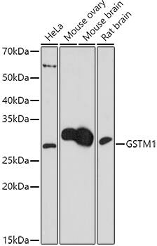 Western Blot: GST Epitope Tag Antibody [NBP3-35752] - Western blot analysis of various lysates using  at 1:1000 dilution.Secondary antibody: HRP-conjugated Goat anti-Rabbit IgG (H+L) at 1:10000 dilution.Lysates/proteins: 25μg per lane.Blocking buffer: 3% nonfat dry milk in TBST.Detection: ECL Basic Kit.Exposure time: 180s.