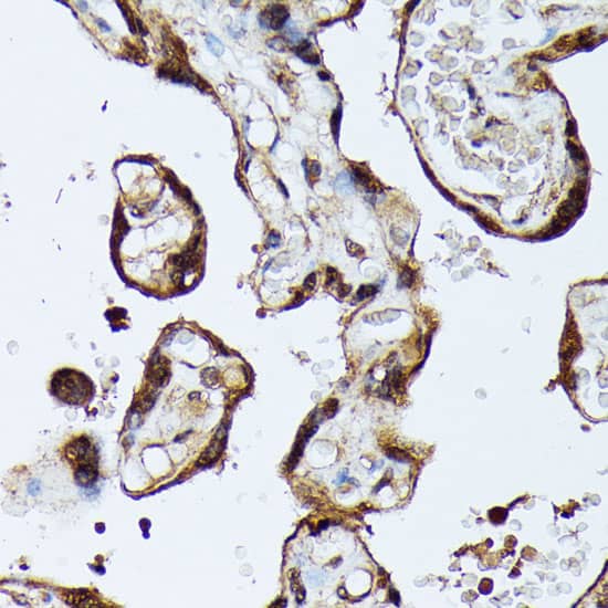 Immunohistochemistry: MAK Antibody [NBP3-35755] - Immunohistochemistry analysis of paraffin-embedded Human placenta using MAK Rabbit pAb at dilution of 1:100 (40x lens). Microwave antigen retrieval performed with 0.01M PBS Buffer (pH 7.2) prior to IHC staining.