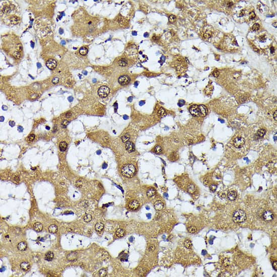 Immunohistochemistry: MAK Antibody [NBP3-35755] - Immunohistochemistry analysis of paraffin-embedded Human liver using MAK Rabbit pAb at dilution of 1:100 (40x lens). Microwave antigen retrieval performed with 0.01M PBS Buffer (pH 7.2) prior to IHC staining.