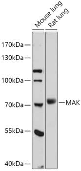 Western Blot: MAK Antibody [NBP3-35755] - Western blot analysis of various lysates using MAK Rabbit pAb at 1:1000 dilution.Secondary antibody: HRP-conjugated Goat anti-Rabbit IgG (H+L) at 1:10000 dilution.Lysates/proteins: 25ug per lane.Blocking buffer: 3% nonfat dry milk in TBST.Detection: ECL Basic Kit.Exposure time: 90s.