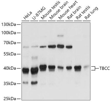 Western Blot: TBCC Antibody [NBP3-35758] - Western blot analysis of various lysates using TBCC Rabbit pAb at 1:3000 dilution.Secondary antibody: HRP-conjugated Goat anti-Rabbit IgG (H+L) at 1:10000 dilution.Lysates/proteins: 25ug per lane.Blocking buffer: 3% nonfat dry milk in TBST.Detection: ECL Basic Kit.Exposure time: 1s.