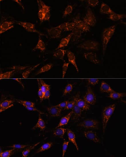 Immunocytochemistry/ Immunofluorescence: TBCC Antibody [NBP3-35758] - Immunofluorescence analysis of C6 cells using TBCC Rabbit pAb at dilution of 1:100. Secondary antibody: Cy3-conjugated Goat anti-Rabbit IgG (H+L) at 1:500 dilution. Blue: DAPI for nuclear staining.