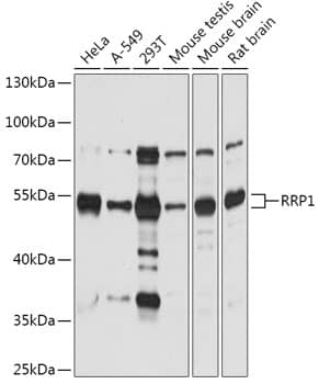 Western Blot: RRP1 Antibody [NBP3-35760] - Western blot analysis of various lysates using RRP1 Rabbit pAb at 1:1000 dilution.Secondary antibody: HRP-conjugated Goat anti-Rabbit IgG (H+L) at 1:10000 dilution.Lysates/proteins: 25ug per lane.Blocking buffer: 3% nonfat dry milk in TBST.Detection: ECL Basic Kit.Exposure time: 60s.