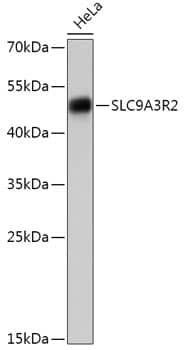 Western Blot: NHERF-2 Antibody [NBP3-35762] - Western blot analysis of lysates from HeLa cells, using NHERF-2 Rabbit pAb at 1:1000 dilution.Secondary antibody: HRP-conjugated Goat anti-Rabbit IgG (H+L) at 1:10000 dilution.Lysates/proteins: 25ug per lane.Blocking buffer: 3% nonfat dry milk in TBST.Detection: ECL Basic Kit.Exposure time: 10s.