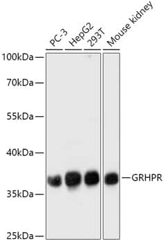 Western Blot: GRHPR Antibody [NBP3-35763] - Western blot analysis of various lysates using GRHPR Rabbit pAb at 1:1000 dilution.Secondary antibody: HRP-conjugated Goat anti-Rabbit IgG (H+L) at 1:10000 dilution.Lysates/proteins: 25ug per lane.Blocking buffer: 3% nonfat dry milk in TBST.Detection: ECL Basic Kit.Exposure time: 1s.