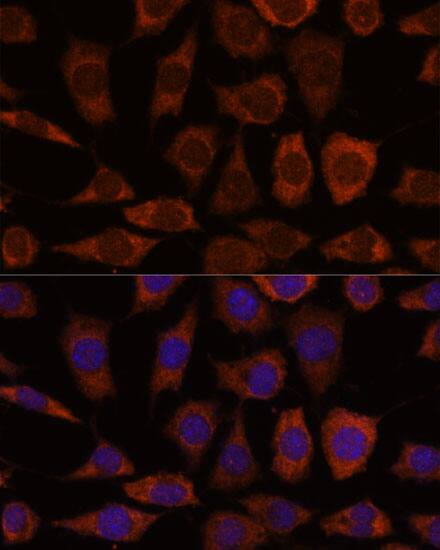 Immunocytochemistry/ Immunofluorescence: GRHPR Antibody [NBP3-35763] - Immunofluorescence analysis of L929 cells using GRHPR Rabbit pAb at dilution of 1:100. Secondary antibody: Cy3-conjugated Goat anti-Rabbit IgG (H+L) at 1:500 dilution. Blue: DAPI for nuclear staining.