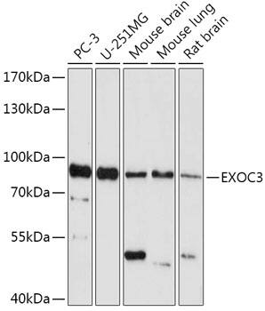 Western Blot: SEC6 Antibody [NBP3-35769] - Western blot analysis of various lysates using SEC6 Rabbit pAb at 1:1000 dilution.Secondary antibody: HRP-conjugated Goat anti-Rabbit IgG (H+L) at 1:10000 dilution.Lysates/proteins: 25ug per lane.Blocking buffer: 3% nonfat dry milk in TBST.Detection: ECL Basic Kit.Exposure time: 5min.