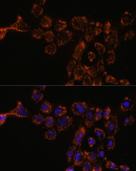 Immunocytochemistry/ Immunofluorescence: HspA4L Antibody [NBP3-35770] - Immunofluorescence analysis of A431 cells using HspA4L Rabbit pAb at dilution of 1:100. Secondary antibody: Cy3-conjugated Goat anti-Rabbit IgG (H+L) at 1:500 dilution. Blue: DAPI for nuclear staining.