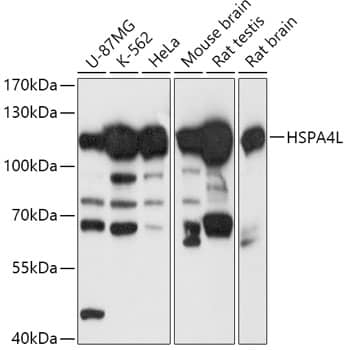 Western Blot: HspA4L Antibody [NBP3-35770] - Western blot analysis of various lysates using HspA4L Rabbit pAb at 1:1000 dilution.Secondary antibody: HRP-conjugated Goat anti-Rabbit IgG (H+L) at 1:10000 dilution.Lysates/proteins: 25ug per lane.Blocking buffer: 3% nonfat dry milk in TBST.Detection: ECL Basic Kit.Exposure time: 5s.