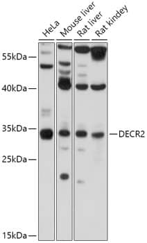 Western Blot: DECR2 Antibody [NBP3-35773] - Western blot analysis of various lysates using DECR2 Rabbit pAb at 1:1000 dilution.Secondary antibody: HRP-conjugated Goat anti-Rabbit IgG (H+L) at 1:10000 dilution.Lysates/proteins: 25ug per lane.Blocking buffer: 3% nonfat dry milk in TBST.Detection: ECL Basic Kit.Exposure time: 3s.