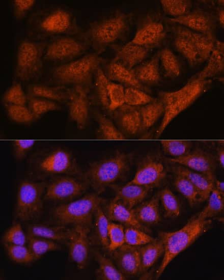 Immunocytochemistry/ Immunofluorescence NOB1 Antibody