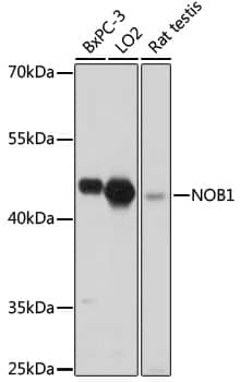 Western Blot NOB1 Antibody