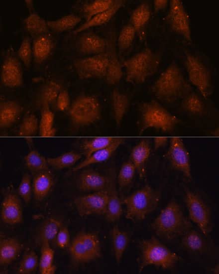 Immunocytochemistry/ Immunofluorescence NOB1 Antibody