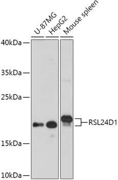 Western Blot: RPL24/RLP24 Antibody [NBP3-35776] - Western blot analysis of various lysates using RPL24/RLP24 Rabbit pAb at 1:1000 dilution.Secondary antibody: HRP-conjugated Goat anti-Rabbit IgG (H+L) at 1:10000 dilution.Lysates/proteins: 25ug per lane.Blocking buffer: 3% nonfat dry milk in TBST.Detection: ECL Basic Kit.Exposure time: 3min.