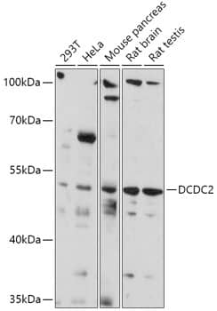 Western Blot: DCDC2 Antibody [NBP3-35777] - Western blot analysis of various lysates using DCDC2 Rabbit pAb at 1:1000 dilution.Secondary antibody: HRP-conjugated Goat anti-Rabbit IgG (H+L) at 1:10000 dilution.Lysates/proteins: 25ug per lane.Blocking buffer: 3% nonfat dry milk in TBST.Detection: ECL Basic Kit.Exposure time: 3min.