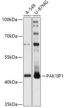 Western Blot: PAK1 interacting protein 1 Antibody [NBP3-35778] - Western blot analysis of various lysates using PAK1 interacting protein 1 Rabbit pAb at 1:1000 dilution.Secondary antibody: HRP-conjugated Goat anti-Rabbit IgG (H+L) at 1:10000 dilution.Lysates/proteins: 25ug per lane.Blocking buffer: 3% nonfat dry milk in TBST.Detection: ECL Basic Kit.Exposure time: 10s.