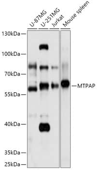 Western Blot: PAPD1 Antibody [NBP3-35779] - Western blot analysis of various lysates using PAPD1 Rabbit pAb at 1:1000 dilution.Secondary antibody: HRP-conjugated Goat anti-Rabbit IgG (H+L) at 1:10000 dilution.Lysates/proteins: 25ug per lane.Blocking buffer: 3% nonfat dry milk in TBST.Detection: ECL Basic Kit.Exposure time: 10s.