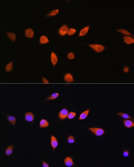 Immunocytochemistry/ Immunofluorescence: Rab20 Antibody [NBP3-35781] - Immunofluorescence analysis of L929 cells using Rab20 Rabbit pAb at dilution of 1:100. Secondary antibody: Cy3-conjugated Goat anti-Rabbit IgG (H+L) at 1:500 dilution. Blue: DAPI for nuclear staining.