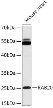 Western Blot: Rab20 Antibody [NBP3-35781] - Western blot analysis of lysates from Mouse heart, using Rab20 Rabbit pAb at 1:1000 dilution.Secondary antibody: HRP-conjugated Goat anti-Rabbit IgG (H+L) at 1:10000 dilution.Lysates/proteins: 25ug per lane.Blocking buffer: 3% nonfat dry milk in TBST.Detection: ECL Basic Kit.Exposure time: 15s.