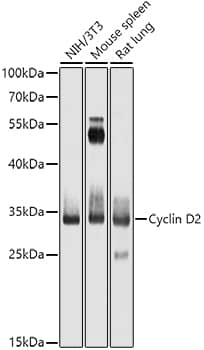 Western Blot: Cyclin D2 Antibody [NBP3-35782] - Western blot analysis of various lysates using Cyclin D2 Rabbit pAb at 1:1000 dilution.Secondary antibody: HRP-conjugated Goat anti-Rabbit IgG (H+L) at 1:10000 dilution.Lysates/proteins: 25ug per lane.Blocking buffer: 3% nonfat dry milk in TBST.Detection: ECL Basic Kit.Exposure time: 30s.