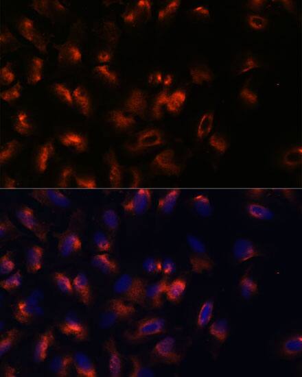 Immunocytochemistry/ Immunofluorescence: STIM2 Antibody [NBP3-35783] - Immunofluorescence analysis of U-2 OS cells using STIM2 Rabbit pAb at dilution of 1:100. Secondary antibody: Cy3-conjugated Goat anti-Rabbit IgG (H+L) at 1:500 dilution. Blue: DAPI for nuclear staining.