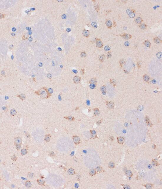 Immunohistochemistry: STIM2 Antibody [NBP3-35783] - Immunohistochemistry analysis of paraffin-embedded Mouse brain using STIM2 Rabbit pAb at dilution of 1:100 (40x lens). Microwave antigen retrieval performed with 0.01M PBS Buffer (pH 7.2) prior to IHC staining.