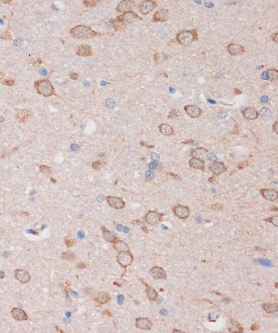 Immunohistochemistry: STIM2 Antibody [NBP3-35783] - Immunohistochemistry analysis of paraffin-embedded Rat brain using STIM2 Rabbit pAb at dilution of 1:100 (40x lens). Microwave antigen retrieval performed with 0.01M PBS Buffer (pH 7.2) prior to IHC staining.