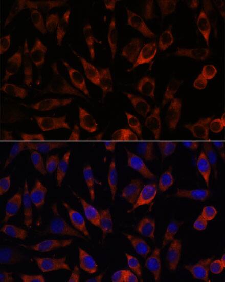 Immunocytochemistry/ Immunofluorescence: STIM2 Antibody [NBP3-35783] - Immunofluorescence analysis of L929 cells using STIM2 Rabbit pAb at dilution of 1:100. Secondary antibody: Cy3-conjugated Goat anti-Rabbit IgG (H+L) at 1:500 dilution. Blue: DAPI for nuclear staining.