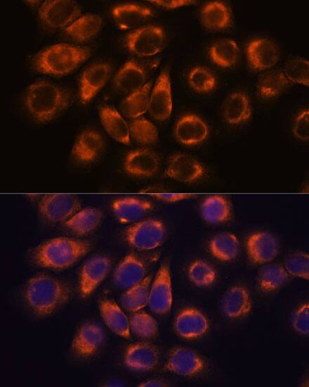 Immunocytochemistry/ Immunofluorescence: SMAP1 Antibody [NBP3-35784] - Immunofluorescence analysis of HeLa cells using SMAP1 Rabbit pAb at dilution of 1:100. Secondary antibody: Cy3-conjugated Goat anti-Rabbit IgG (H+L) at 1:500 dilution. Blue: DAPI for nuclear staining.