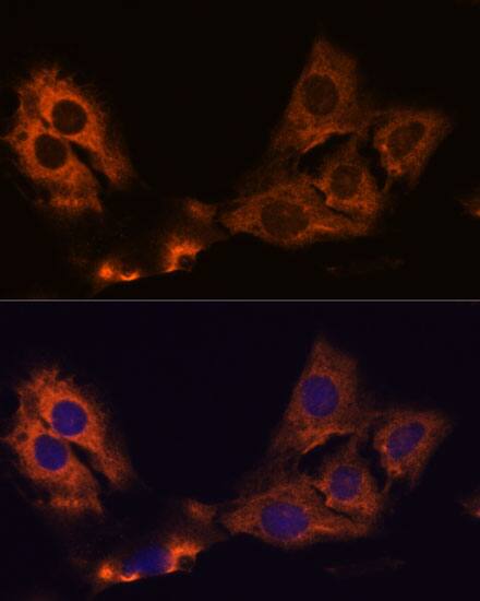 Immunocytochemistry/ Immunofluorescence: SMAP1 Antibody [NBP3-35784] - Immunofluorescence analysis of C6 cells using SMAP1 Rabbit pAb at dilution of 1:100. Secondary antibody: Cy3-conjugated Goat anti-Rabbit IgG (H+L) at 1:500 dilution. Blue: DAPI for nuclear staining.