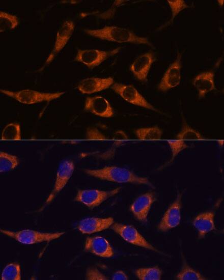 Immunocytochemistry/ Immunofluorescence: SMAP1 Antibody [NBP3-35784] - Immunofluorescence analysis of L929 cells using SMAP1 Rabbit pAb at dilution of 1:100. Secondary antibody: Cy3-conjugated Goat anti-Rabbit IgG (H+L) at 1:500 dilution. Blue: DAPI for nuclear staining.