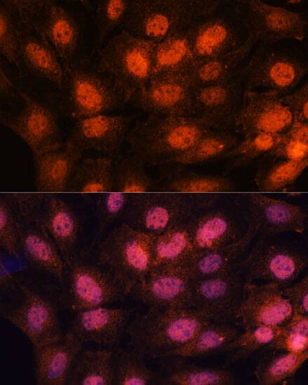 Immunocytochemistry/ Immunofluorescence: CHTF18 Antibody [NBP3-35785] - Immunofluorescence analysis of C6 cells using CHTF18 Rabbit pAb at dilution of 1:100. Secondary antibody: Cy3-conjugated Goat anti-Rabbit IgG (H+L) at 1:500 dilution. Blue: DAPI for nuclear staining.