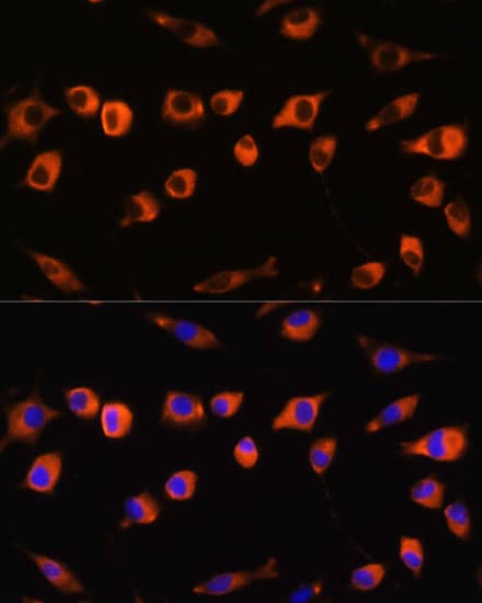 Immunocytochemistry/ Immunofluorescence: SCIN Antibody [NBP3-35789] - Immunofluorescence analysis of L929 cells using SCIN Rabbit pAb at dilution of 1:100. Secondary antibody: Cy3-conjugated Goat anti-Rabbit IgG (H+L) at 1:500 dilution. Blue: DAPI for nuclear staining.