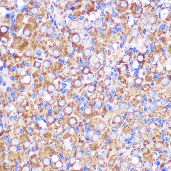 Immunohistochemistry: NEK9 Antibody [NBP3-35791] - Immunohistochemistry analysis of paraffin-embedded Rat ovary using NEK9 Rabbit pAb at dilution of 1:100 (40x lens). Microwave antigen retrieval performed with 0.01M PBS Buffer (pH 7.2) prior to IHC staining.