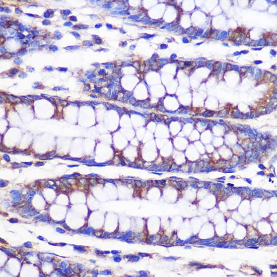 Immunohistochemistry: NEK9 Antibody [NBP3-35791] - Immunohistochemistry analysis of paraffin-embedded Human colon using NEK9 Rabbit pAb at dilution of 1:100 (40x lens). Microwave antigen retrieval performed with 0.01M PBS Buffer (pH 7.2) prior to IHC staining.