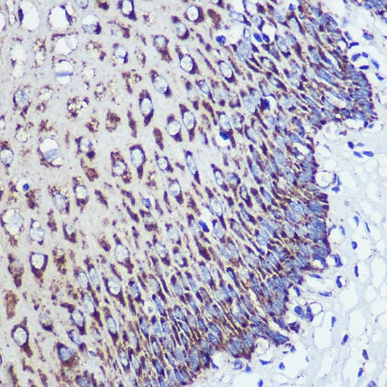 Immunohistochemistry: ORP8 Antibody [NBP3-35792] - Immunohistochemistry analysis of paraffin-embedded Human esophageal using ORP8 Rabbit pAb at dilution of 1:100 (40x lens). Microwave antigen retrieval performed with 0.01M PBS Buffer (pH 7.2) prior to IHC staining.