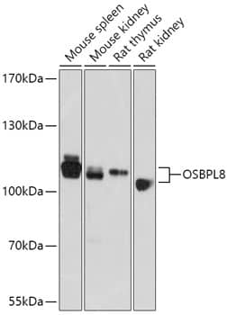 Western Blot: ORP8 Antibody [NBP3-35792] - Western blot analysis of various lysates using ORP8 Rabbit pAb at 1:1000 dilution.Secondary antibody: HRP-conjugated Goat anti-Rabbit IgG (H+L) at 1:10000 dilution.Lysates/proteins: 25ug per lane.Blocking buffer: 3% nonfat dry milk in TBST.Detection: ECL Basic Kit.Exposure time: 10s.