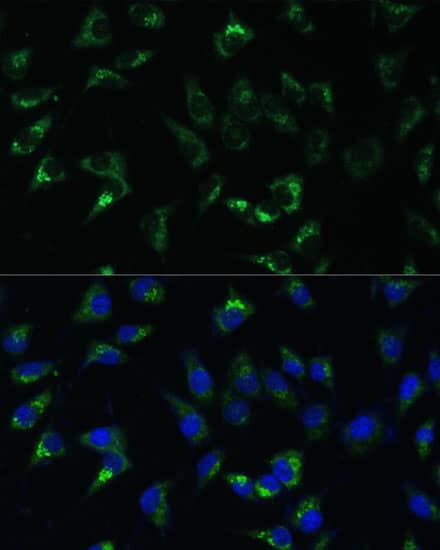 Immunocytochemistry/ Immunofluorescence: USP46 Antibody [NBP3-35794] - Immunofluorescence analysis of L-929 cells using USP46 Rabbit pAb at dilution of 1:100 (40x lens). Secondary antibody: Cy3-conjugated Goat anti-Rabbit IgG (H+L) at 1:500 dilution. Blue: DAPI for nuclear staining.