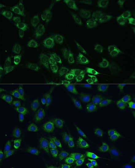 Immunocytochemistry/ Immunofluorescence: USP46 Antibody [NBP3-35794] - Immunofluorescence analysis of C6 cells using USP46 Rabbit pAb at dilution of 1:100 (40x lens). Secondary antibody: Cy3-conjugated Goat anti-Rabbit IgG (H+L) at 1:500 dilution. Blue: DAPI for nuclear staining.