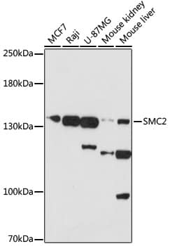 Western Blot: SMC2 Antibody [NBP3-35795] - Western blot analysis of various lysates using SMC2 Rabbit pAb at 1:1000 dilution.Secondary antibody: HRP-conjugated Goat anti-Rabbit IgG (H+L) at 1:10000 dilution.Lysates/proteins: 25ug per lane.Blocking buffer: 3% nonfat dry milk in TBST.Detection: ECL Basic Kit.Exposure time: 30s.