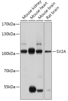 Western Blot: SV2A Antibody [NBP3-35796] - Western blot analysis of various lysates using SV2A Rabbit pAb at 1:1000 dilution.Secondary antibody: HRP-conjugated Goat anti-Rabbit IgG (H+L) at 1:10000 dilution.Lysates/proteins: 25ug per lane.Blocking buffer: 3% nonfat dry milk in TBST.Detection: ECL Basic Kit.Exposure time: 1s.