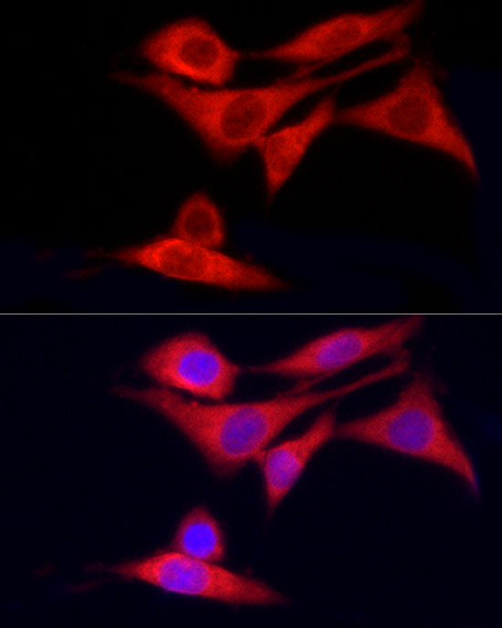 N/A CYP7B1 Antibody