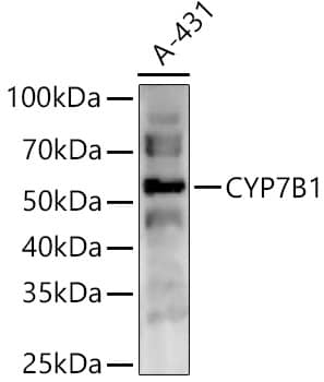 Western Blot CYP7B1 Antibody