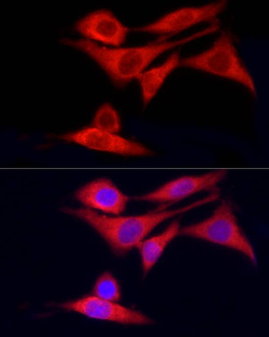 Immunocytochemistry/ Immunofluorescence CYP7B1 Antibody