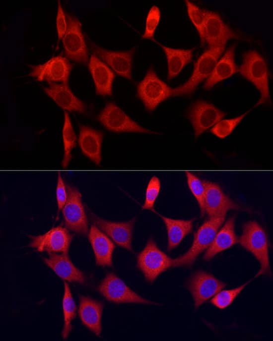 Immunocytochemistry/ Immunofluorescence CYP7B1 Antibody